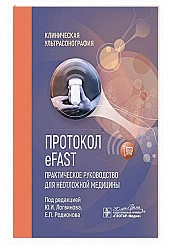 Протокол eFAST. Практическое руководство для неотложной медицины